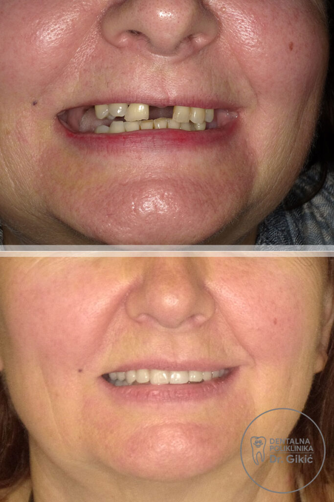 protetika1 protetika