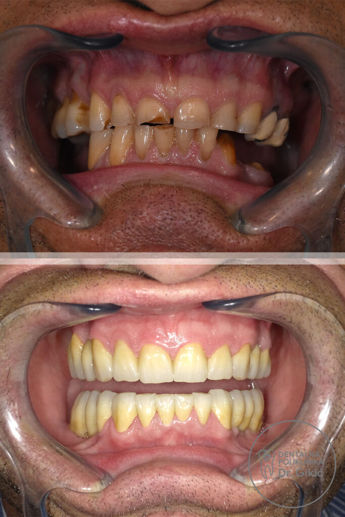 protetika1 protetika