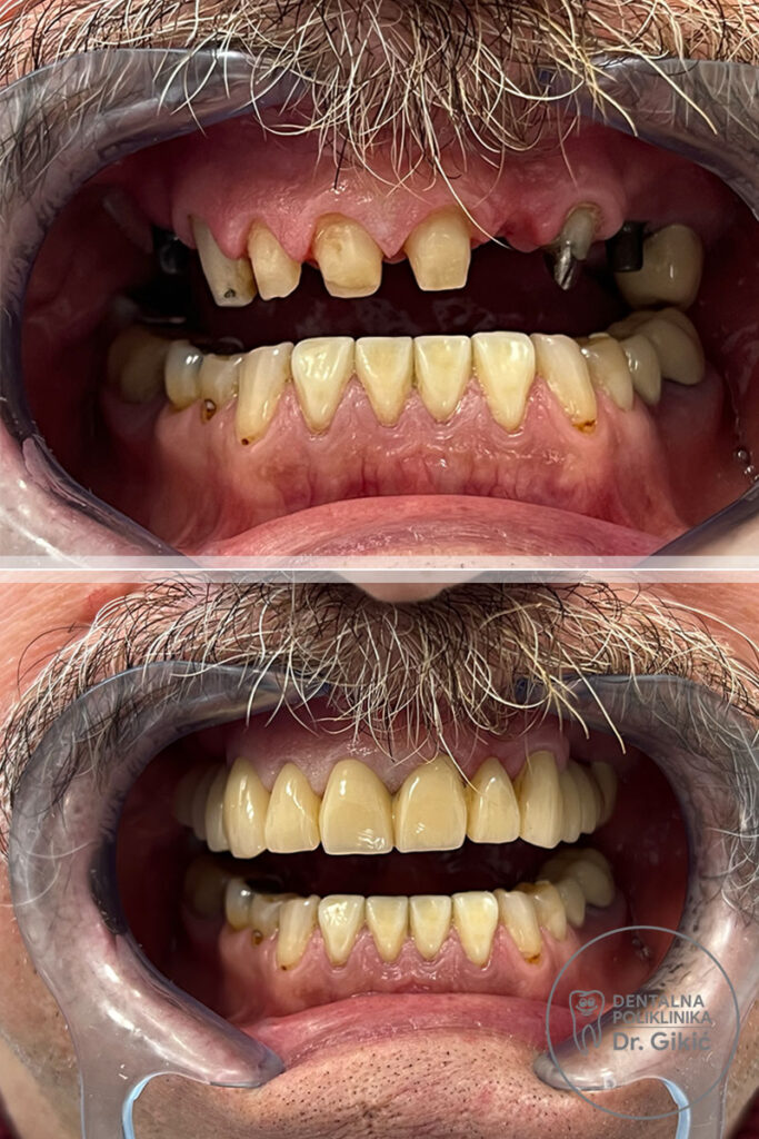 protetika1 protetika