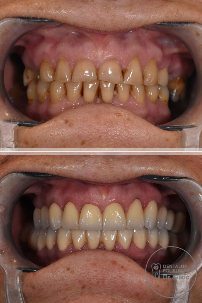 protetika1 protetika